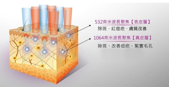 祛痘我用點(diǎn)陣，你呢？！