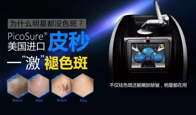 皮秒的優(yōu)勢(shì)是什么？