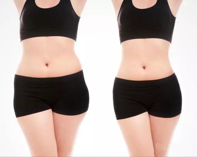 UltraShape優(yōu)立塑非侵入式專利科技、有效、安全！